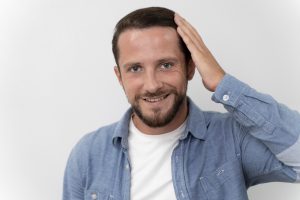 Te contamos las dudas sobre nuestro injerto capilar en Don Benito