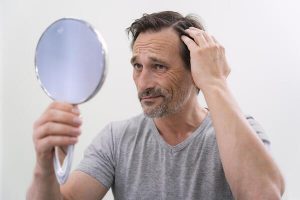 clinica capilar en Don Benito hombre