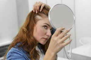 Soluciones a la alopecia femenina